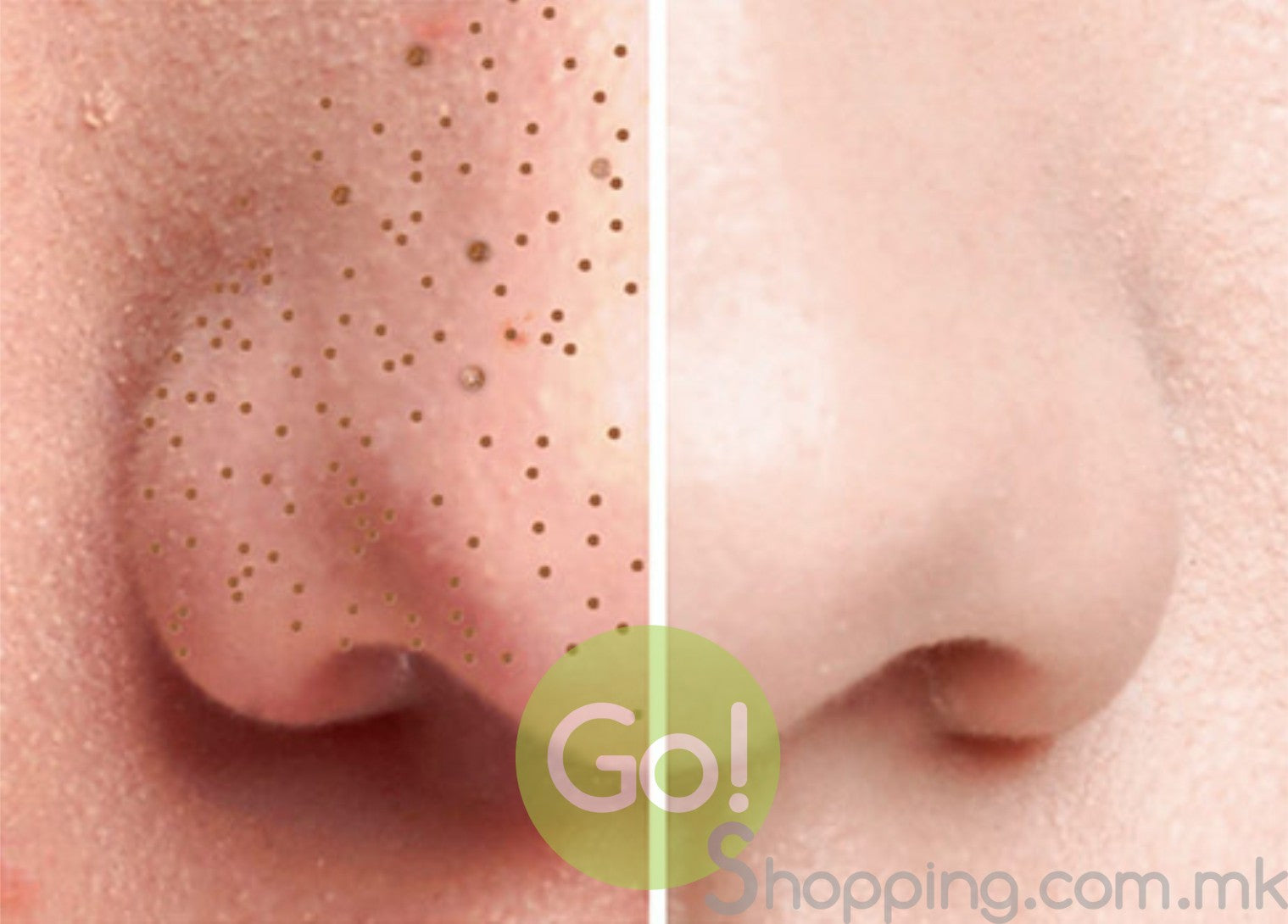 derma suction апарат за чистење лице