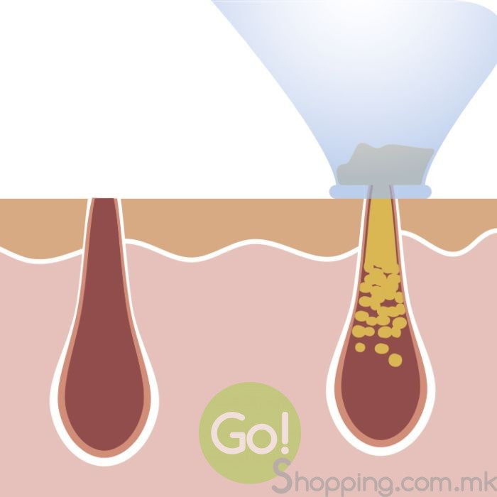 derma suction апарат за чистење лице